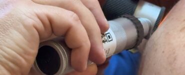 В Подмосковье выявляемость рака на нулевой и первой стадиях составляет 51,5%